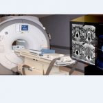image-157917 Κοζάνη: Σ’ ένα μήνα ο αξονικός τομογράφος στο Νοσοκομείο Κοζάνης