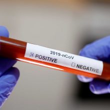 image-294346 H Διεύθυνση Πολιτικής Προστασίας της Περιφέρειας Ηπείρου, για τον άντρα που εργάζεται ως υπάλληλος Τεχνικών Υπηρεσιών της Π.Ε. Πρέβεζας και διαγνώσθηκε, την Παρασκευή 5/6, με κορωνοϊό μετά από δείγμα στο Εργαστήριο Μοριακής Βιολογίας στο Μαμάτσειο νοσοκομείο Κοζάνης