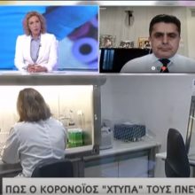 image-283569 kozan.gr: Ο βουλευτής Καστοριάς Ζήσης Τζηκαλάγιας στην ΕΡΤ1 για όλες τις τελευταίες εξελίξεις στην Καστοριά με το θέμα του κορωνοϊού (Βίντεο)