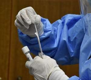 image-324125 Δωρεάν Rapid Tests στο Δήμο Βελβεντού από τον ΕΟΔΥ στις 9 Ιανουαρίου