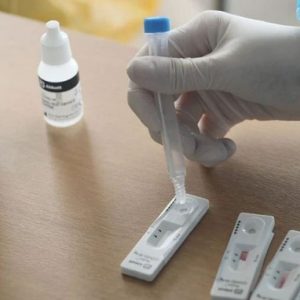 image-370567 Ένωση φοροτεχνικών Κοζάνης: Ποιοι είναι υπόχρεοι για διενέργεια rapid tests και ποιοι εξαιρούνται
