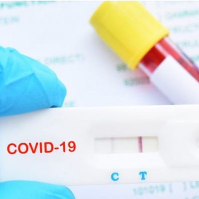 image-341030 Self tests σε όλο το Δημόσιο από Δευτέρα 26 Απριλίου – Από τις 10 Μαΐου θα αυξάνεται η φυσική παρουσία του προσωπικού της δημόσιας διοίκησης στις υπηρεσίες ενώ αντίστοιχα θα μειωθεί το ποσοστό όσων εργάζονται με τηλεργασία